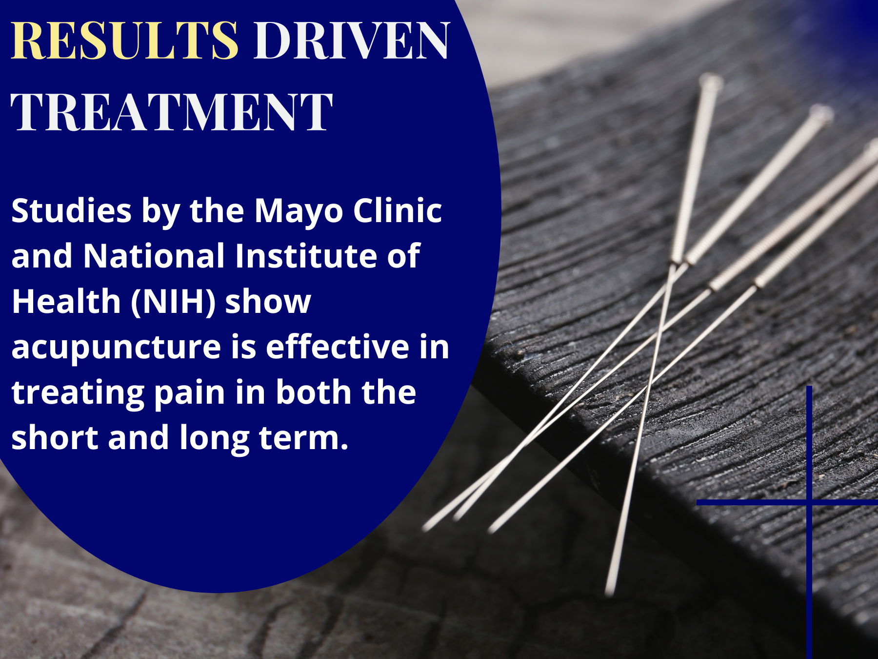 Acutherapy Acupuncture Special