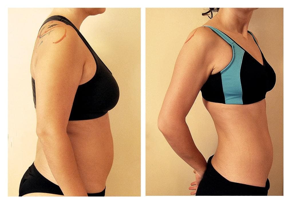 Weight Loss Before After