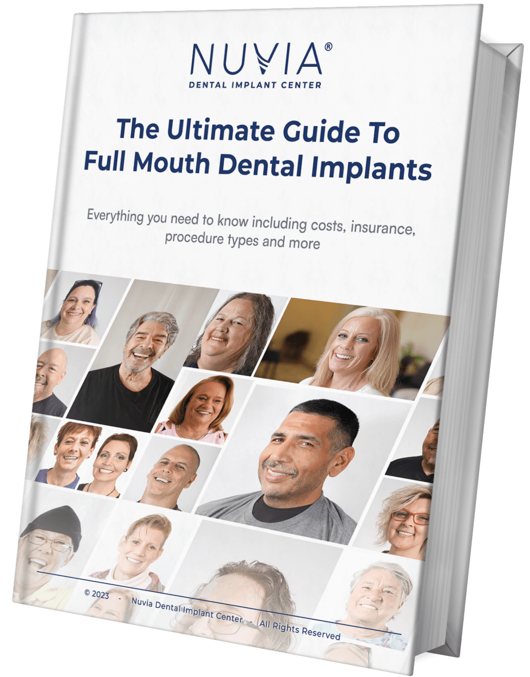 The Ultimate Guide To Full Mouth Dental Implants In 2023