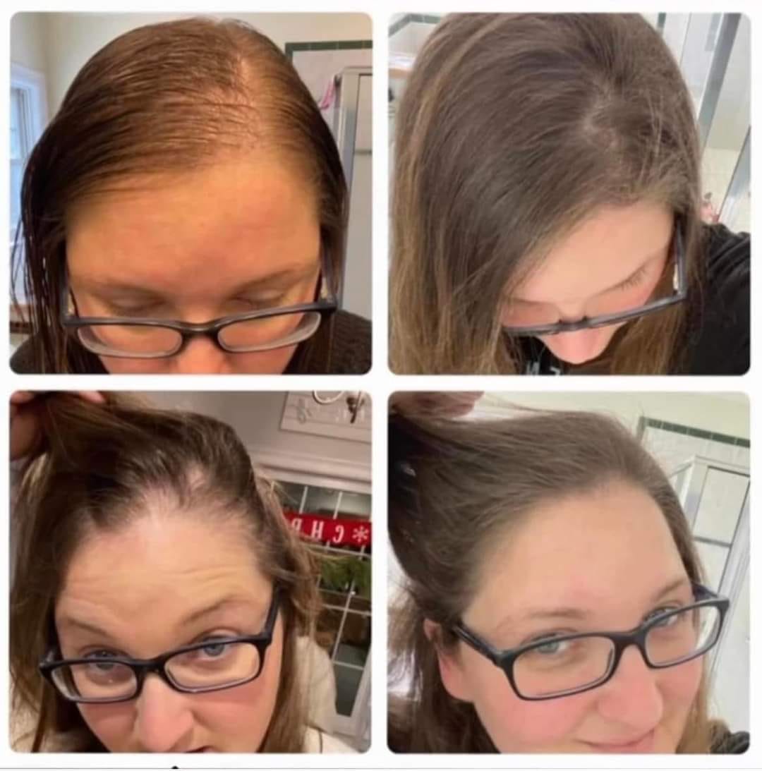 Stronger, Longer Hair with Hair Revival Shop Online