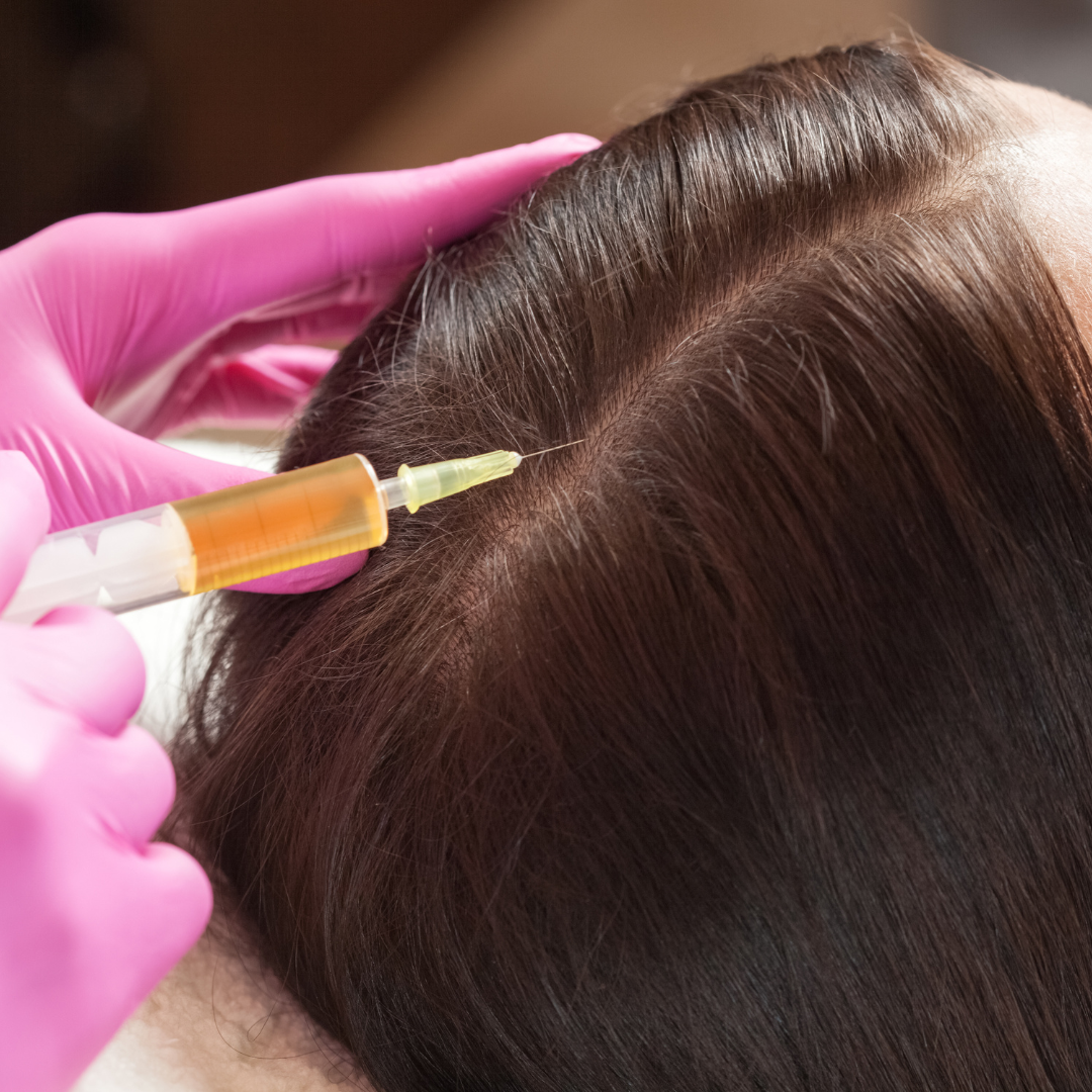 woman getting a PRP injection in her hair for hair rejuvenation and hair growth